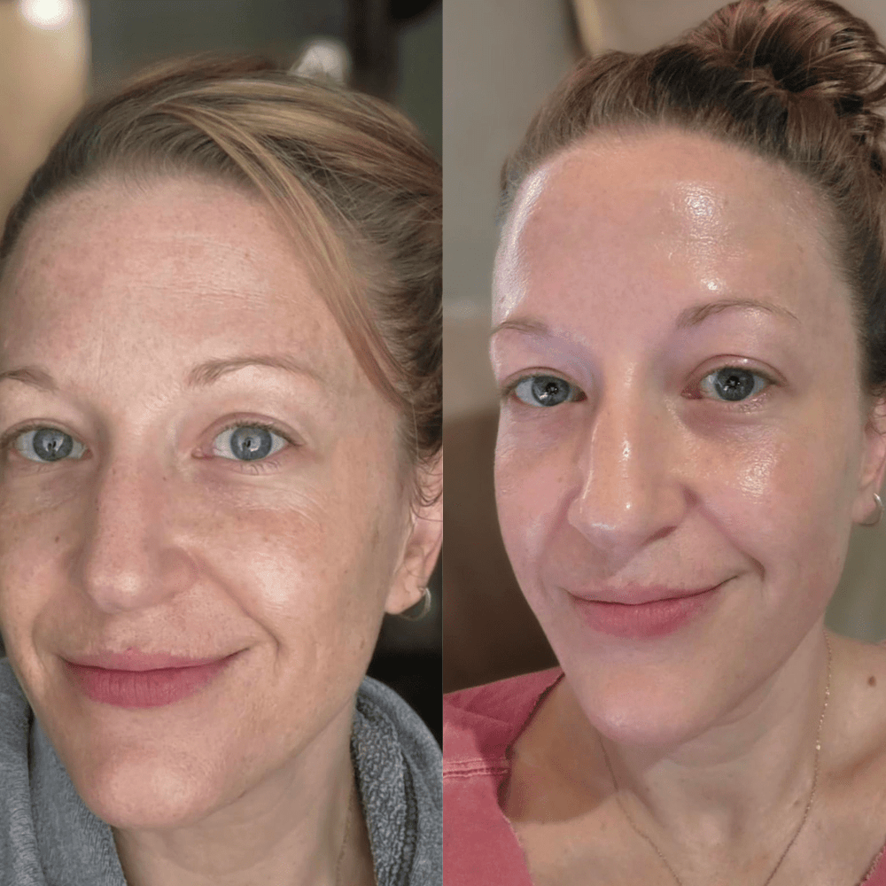 Peel Shot Coréen - Élimine les Impuretés et Sublime Votre Peau