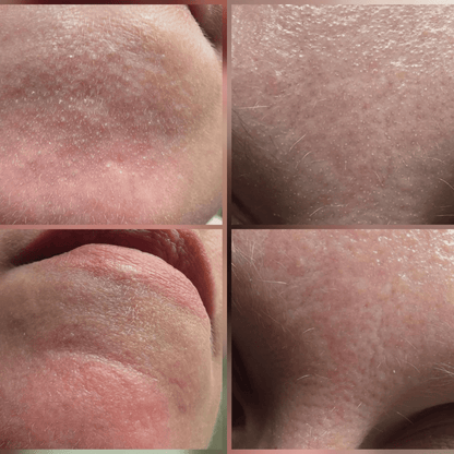 Peel Shot Coréen - Élimine les Impuretés et Sublime Votre Peau